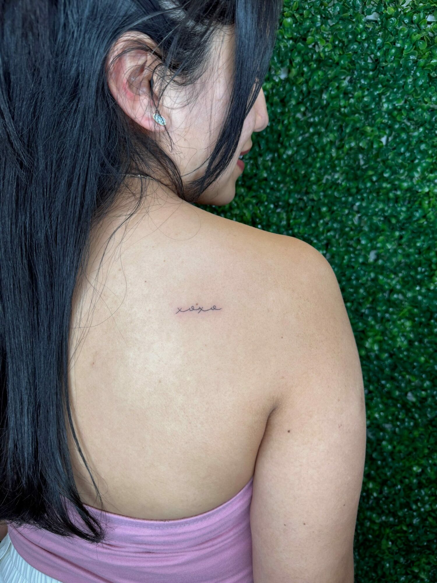 Close-up of a person's shoulder with a small surgical scar, lying on a green textured surface, wearing a pink top.