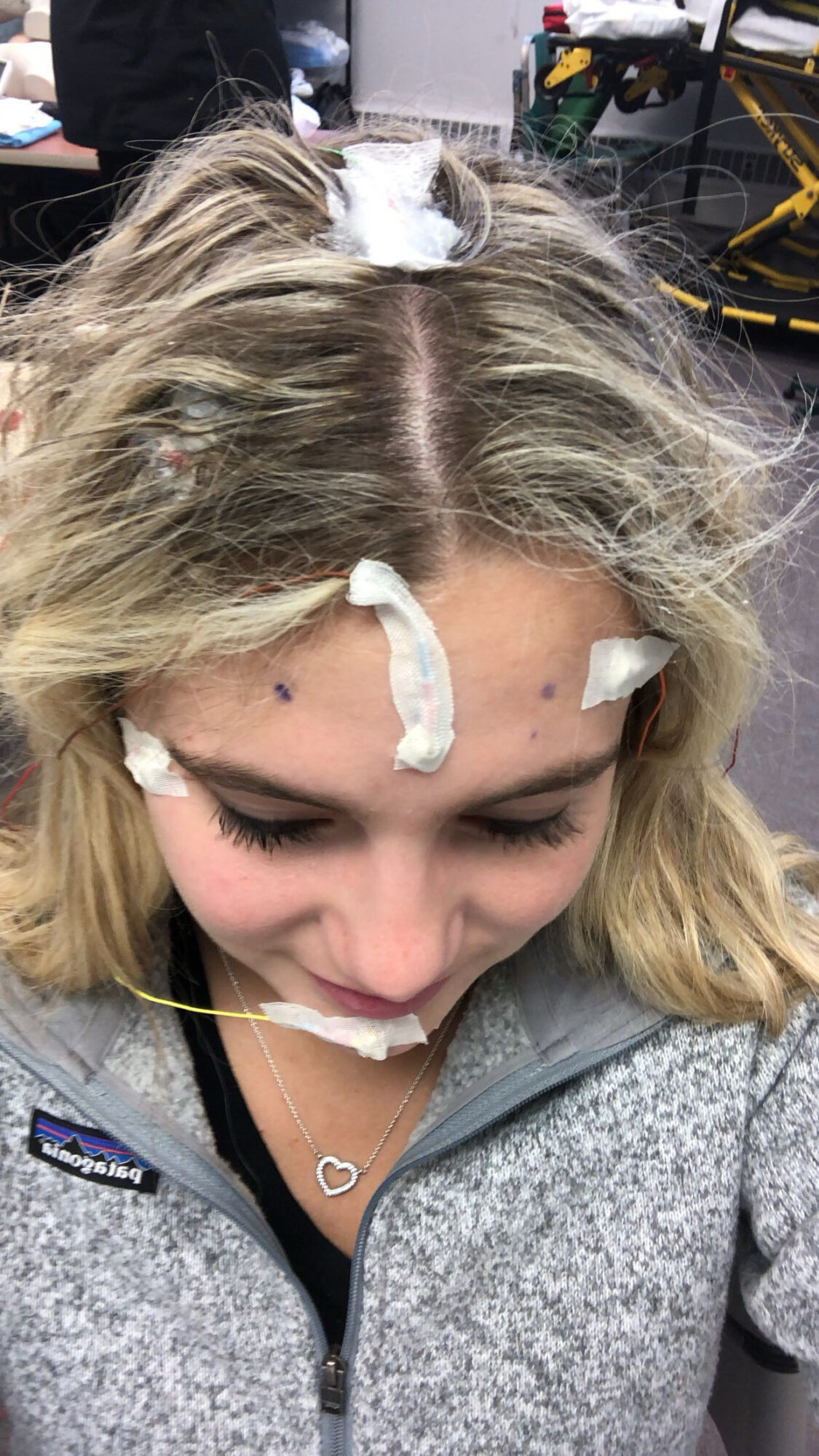 Young woman with blonde hair and bandages on forehead, nose, and chin, looking down, in a room with equipment.