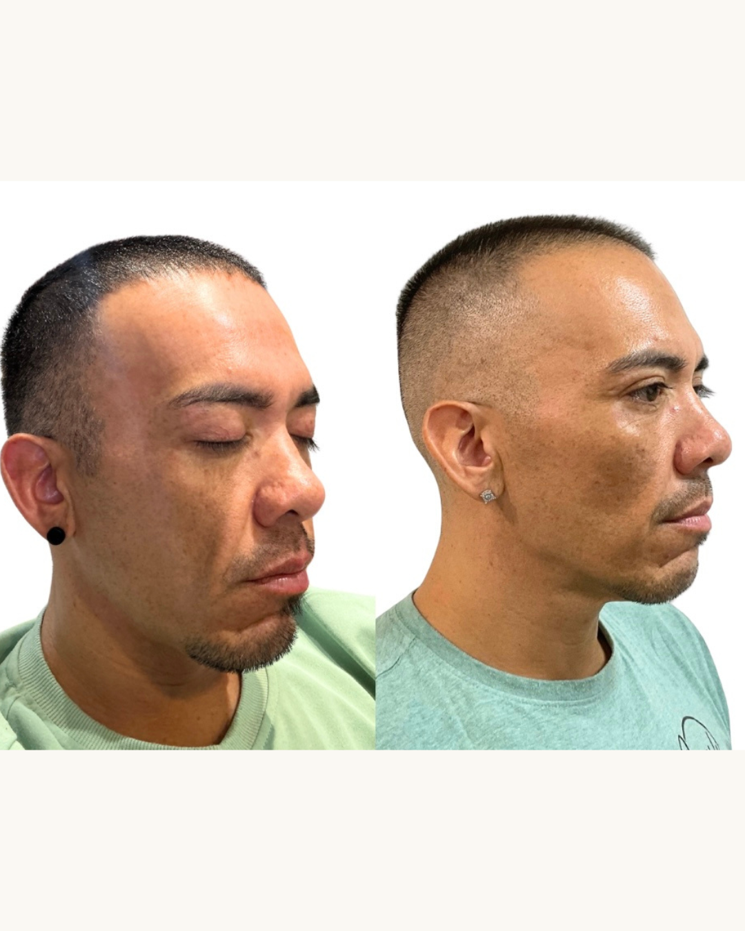 Side-by-side profile of a man with short hair, showing before and after a haircut, facing right.