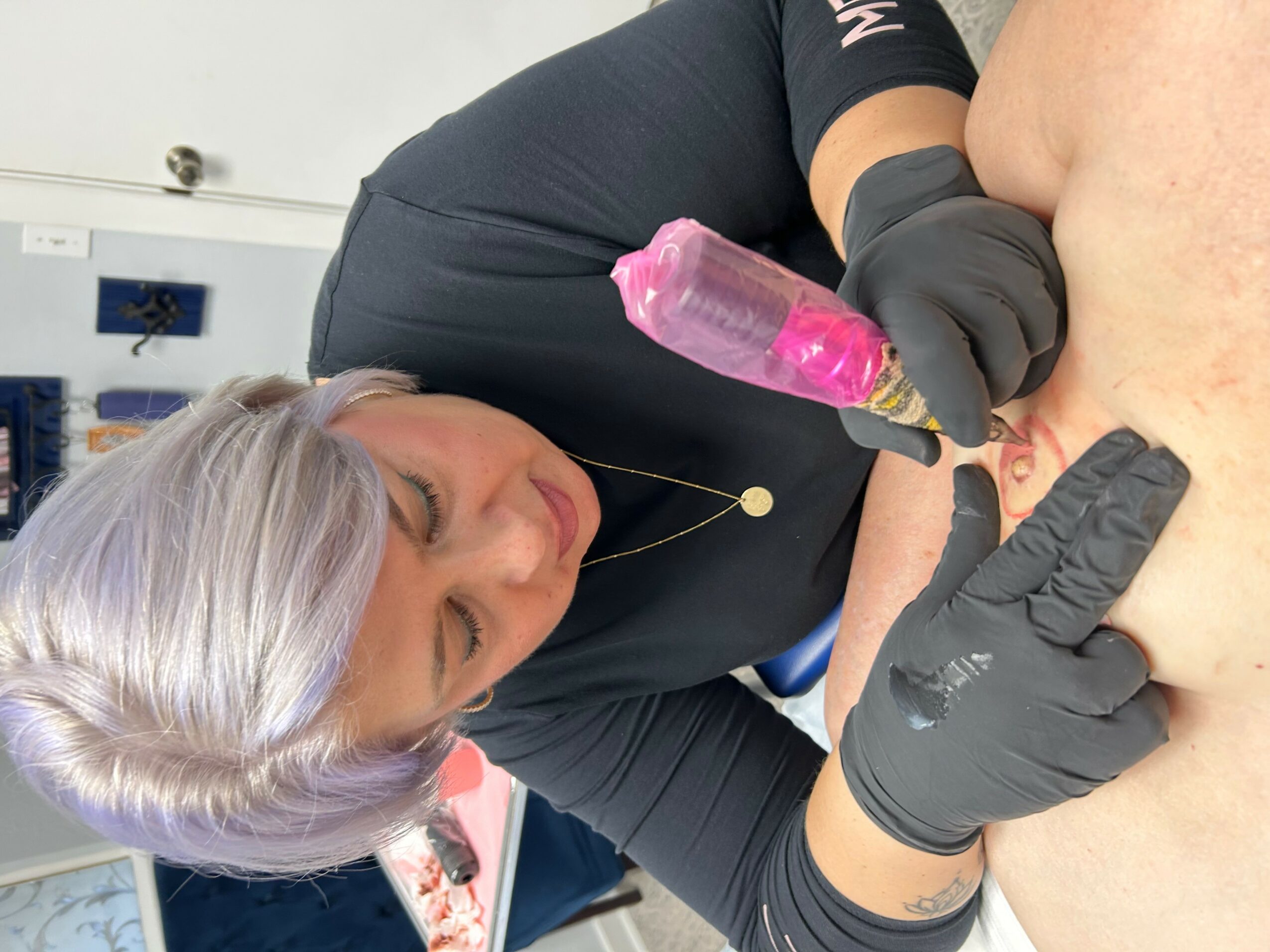 A person with gray hair and black gloves performs a procedure on another person's back in a clinical setting.