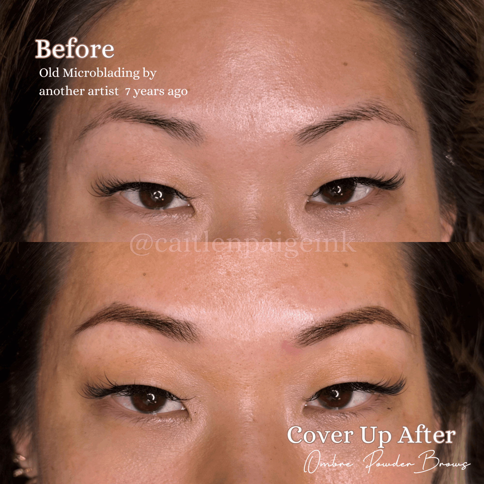 Close-up of a woman's face showing before and after eyelid surgery, with the top image labeled 'Before' and the bottom 'Cover Up After'.