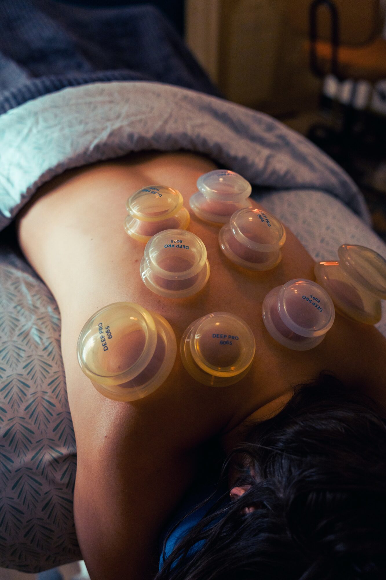 Person lying face down with multiple small containers on their back, in a dimly lit room.