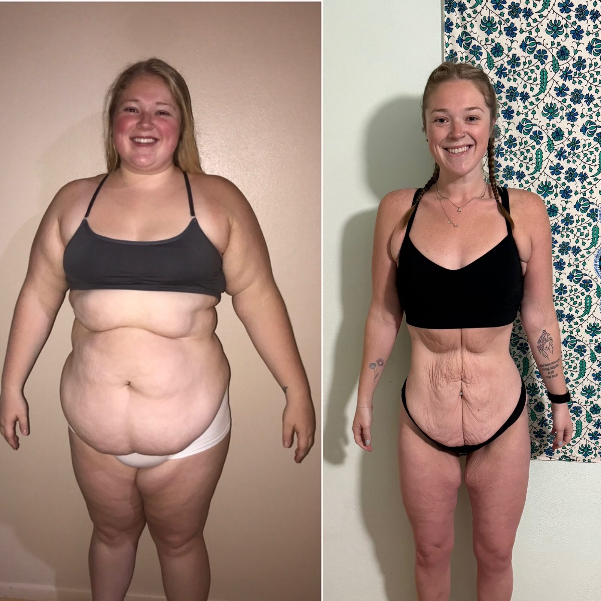 Before and after weight loss transformation of a woman smiling, wearing black top and underwear, showing significant body changes.