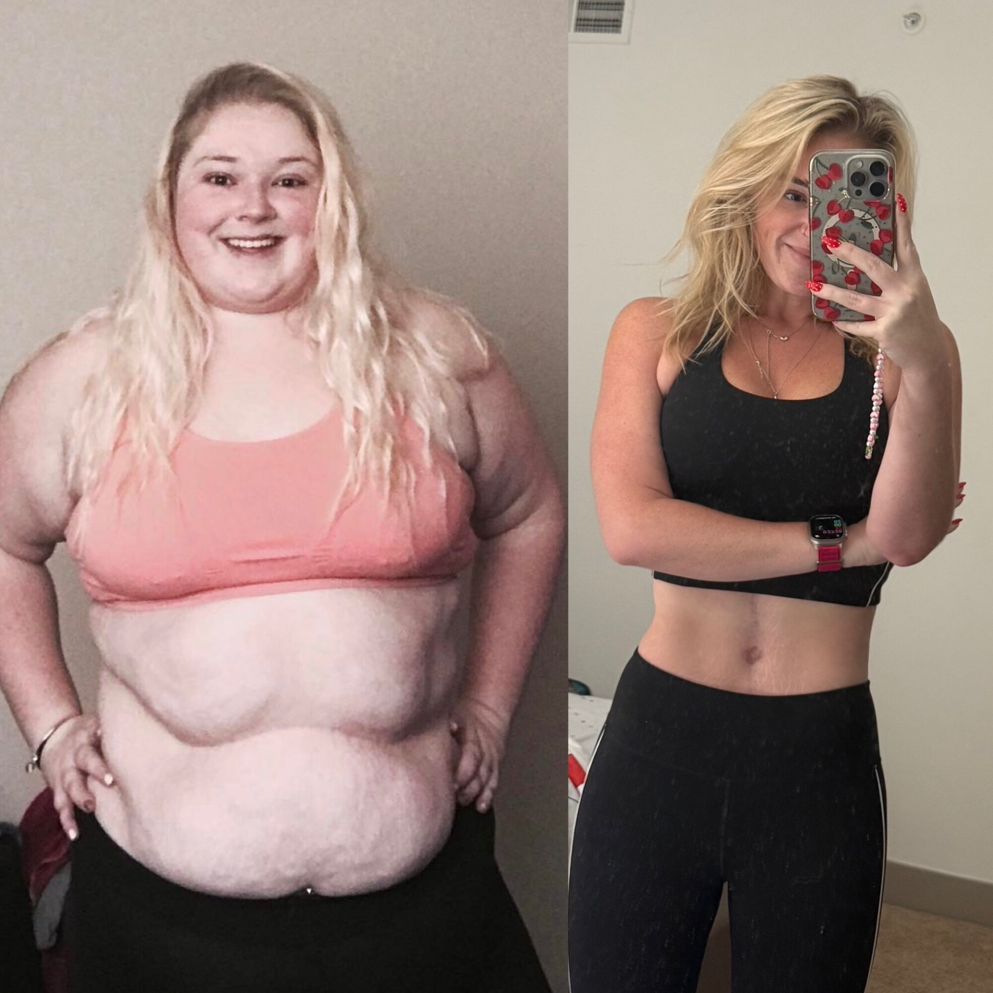 Before and after photos of a woman showing weight loss progress, smiling in both images.