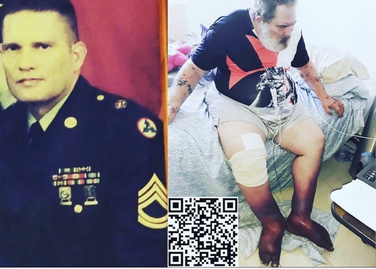 Man in military uniform on left, man with bandages and leg injury sitting on bed on right.
